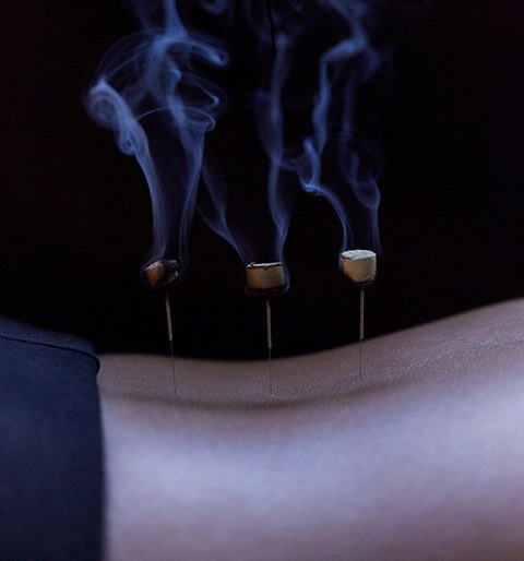 Acupuncture || 60 min